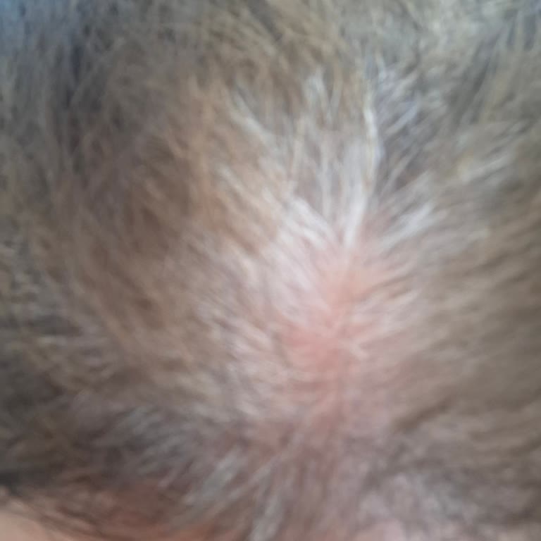 Lila Fix Boya Beyazları Kapatmıyor