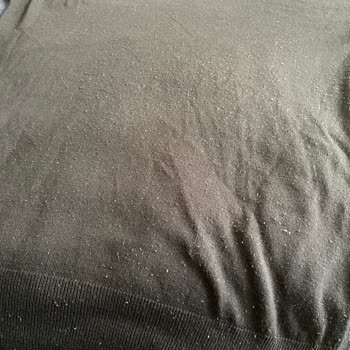 Tüylenen Kazaklar Ve İlgisiz Müşteri Hizmetleri