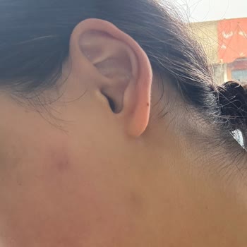 Sesu Tüy Sarartıcı Krem Yüzde Renk Değişikliğine Sebep Oldu