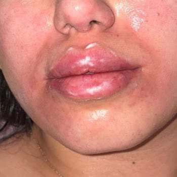 Bellapais Güzellik Merkezi Sağlık Hizmetinde Yaşanan Büyük Hayal Kırıklığı