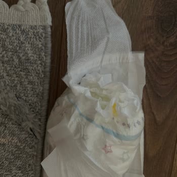 Molfix Bebek Bezi: Kalitesiz Ürün Ve Sağlık Sorunları