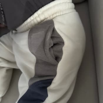 Molfix Bebek Bezi: Kalitesiz Ürün Ve Sağlık Sorunları