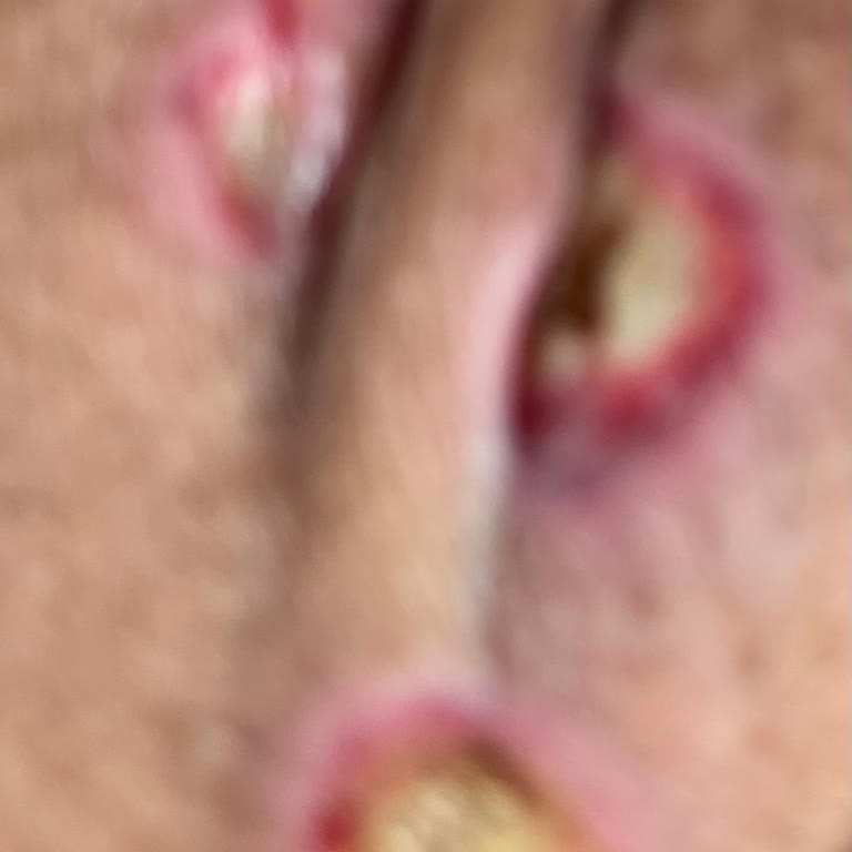 Yanlış Teşhis Ve Gereksiz Ameliyat Mağduriyeti