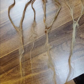 Saç Mikro Kaynak Hizmetinde Büyük Hayal Kırıklığı