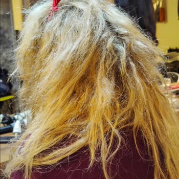 Saç Mikro Kaynak Hizmetinde Büyük Hayal Kırıklığı