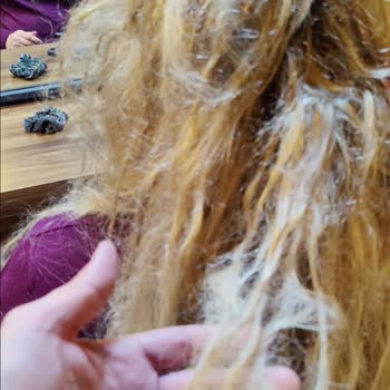 Saç Mikro Kaynak Hizmetinde Büyük Hayal Kırıklığı