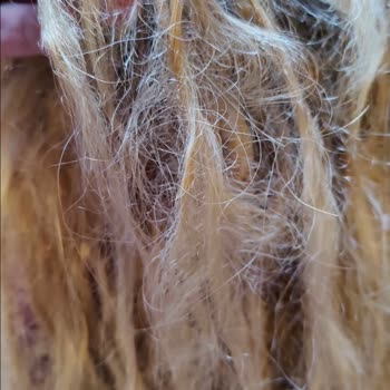 Saç Mikro Kaynak Hizmetinde Büyük Hayal Kırıklığı