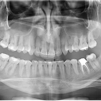 Dentadent Ağız Ve Diş Sağlığı Ömür Boyu Garanti Vaadiyle Yanıltıldım