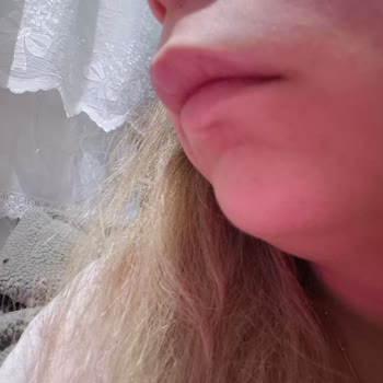 Yanlış Teşhis Ve İlgisizlik Sebebiyle Ciddi Sağlık Sorunları Yaşadım