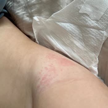 Molfix Bezlerinde Kalite Düşüşü Ve Pişik Sorunu