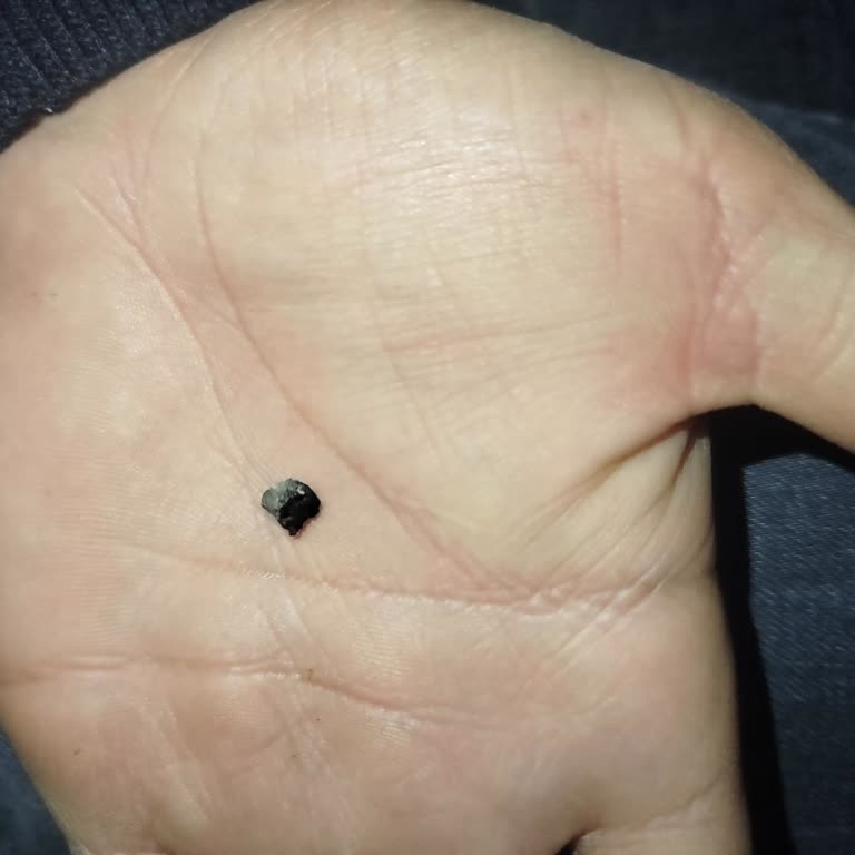 Çikolata İçinden Çıkan Tehlikeli Madde