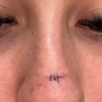 Yanlış İşlemler Ve Müşteri Mağduriyeti