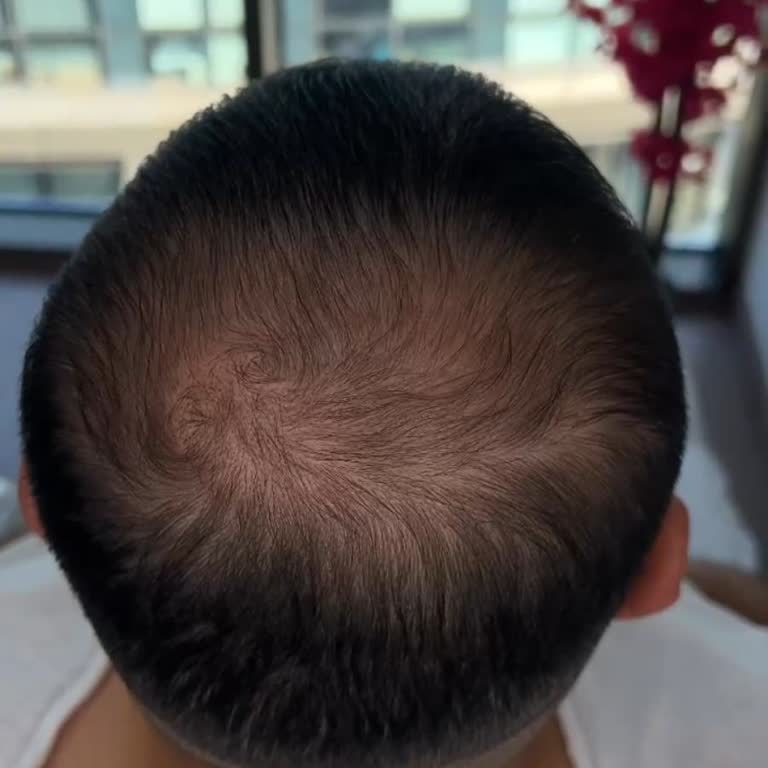 Estetisyen Sibel İğci Beklentiler Boşa Çıktı: Yanıltıcı Hizmet Deneyimi