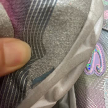 Skechers Ayakkabı Kalitesi Ve Hizmet Sorunu