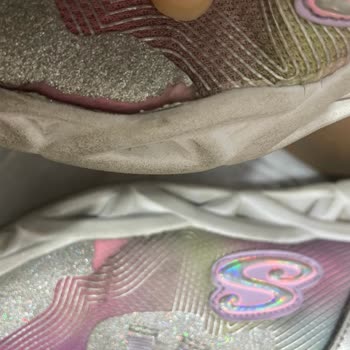 Skechers Ayakkabı Kalitesi Ve Hizmet Sorunu