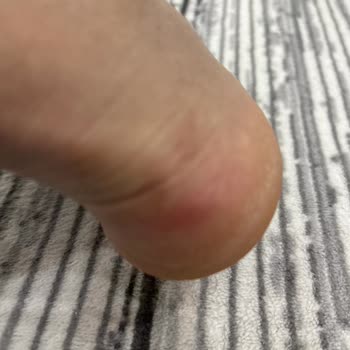 Defolu Ayakkabı Ve İlgisiz Hizmet