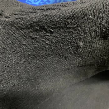 Sementa Kazak Tüylenme Sorunu Ve Müşteri Hizmetleri Cevabı