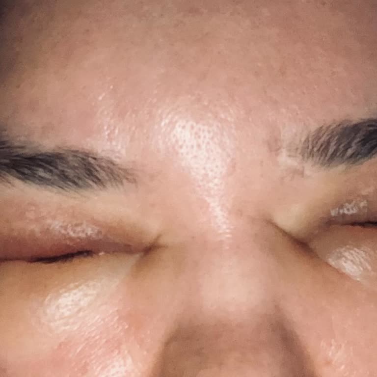 Dr. Levent Özer Acılı Başarısız İşlemler