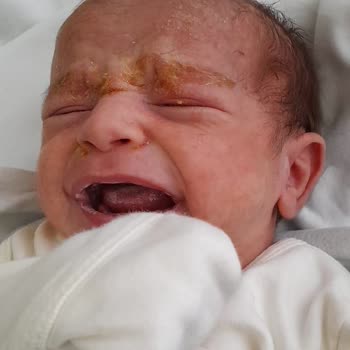 Шампунь Johnsons Baby для младенцев вызвал аллергию