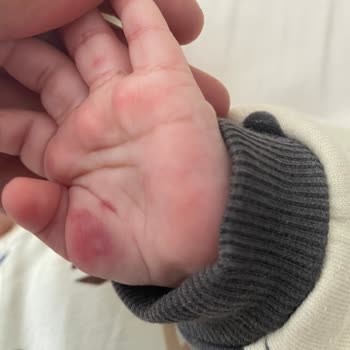 Bebek Kan Alımı Sırasında Yaşanan Sorun