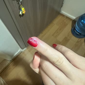 Sterilizasyon Eksikliği İle Sağlık Sorunu Yaşadım