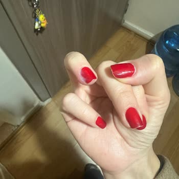 Sterilizasyon Eksikliği İle Sağlık Sorunu Yaşadım