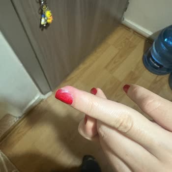 Sterilizasyon Eksikliği İle Sağlık Sorunu Yaşadım