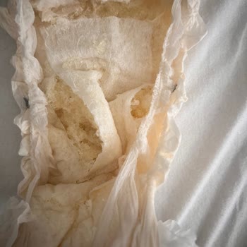 Kalitesiz Bebek Bezi Sorunu