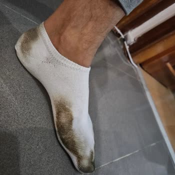 Trendyol Derimod Ürününde Kalıcı Renk Sorunu