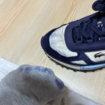 Lacoste Ayakkabıda Boya Salma Sorunu Ve Yetersiz Müşteri Hizmeti