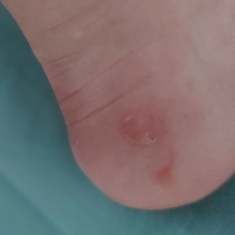 Kukla Shoes Mağduriyet Yaşama