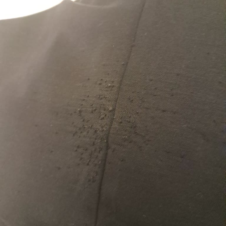Oysho Ürününde Hızlı Tüylenme Ve Yolunma Sorunu