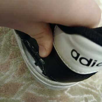 Kısa Sürede Yıpranan Ayakkabı Ve Yetersiz Müşteri Hizmeti