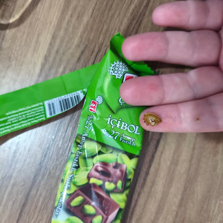 Çikolatada Fıstık Kabuğu Şoku: Dişim Kırıldı!