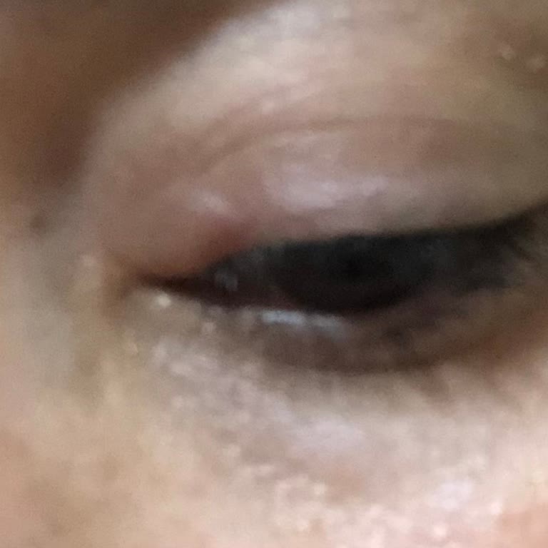 Neutrogena Makyaj Temizleme Mendili Göz Sağlığını Tehdit Ediyor: Acil Önlem Alınmalı!