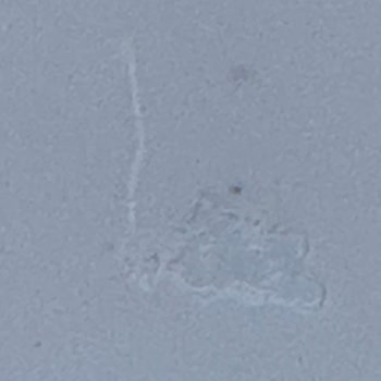 Yetkili Serviste Aracımda Oluşan Hasar Ve İlgisizlik