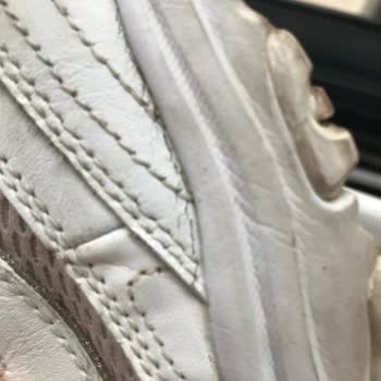 Skechers Ayakkabıda Kalite Sorunu Ve Müşteri Hizmetleri Mağduriyeti