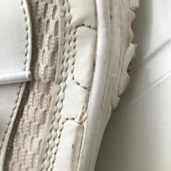 Skechers Ayakkabıda Kalite Sorunu Ve Müşteri Hizmetleri Mağduriyeti