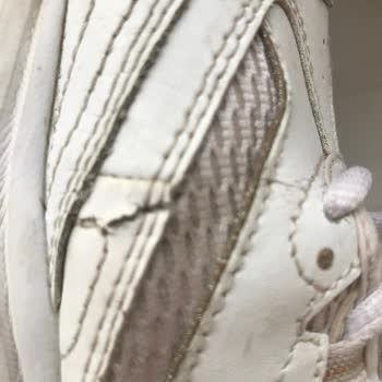 Skechers Ayakkabıda Kalite Sorunu Ve Müşteri Hizmetleri Mağduriyeti
