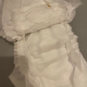 Bebek Bezi İçindeki Şok Edici Hijyen Sorunu