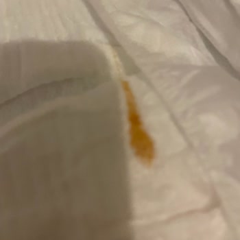 Bebek Bezi İçindeki Şok Edici Hijyen Sorunu