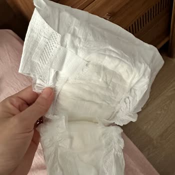 Bebek Bezinde Cırt Sorunu Ve Hayal Kırıklığı