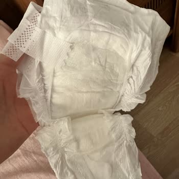 Bebek Bezinde Cırt Sorunu Ve Hayal Kırıklığı