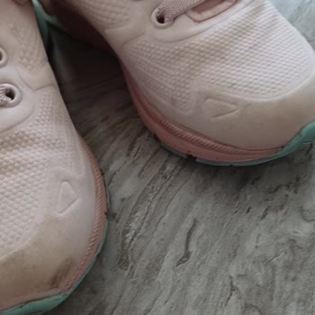 Kalitesiz Malzeme Ve Çıkmayan Lekelerle Hayal Kırıklığı