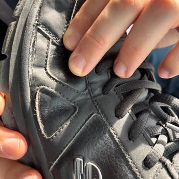 Skechers Ayakkabının Garanti Süresi Ve Kalitesi Hayal Kırıklığı Yarattı