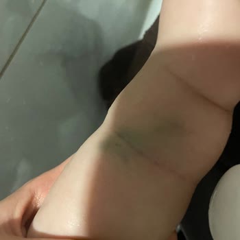 Medicana Sağlık Grubu Bebek Hemşirelerinin Yetersizliği Ve Acı Veren Deneyim!