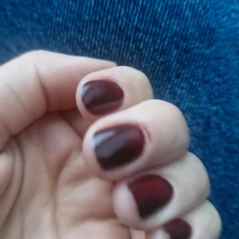 Tırnak Bakımında Dikkatsizlik Ve Sağlık Sorunları