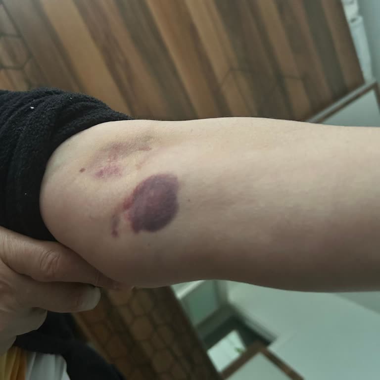 Hastanede Dikkatsiz Kan Alma İşlemi Ve Saygısız Davranış