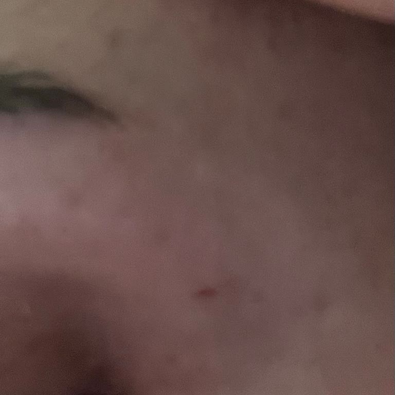 Madam Gold Vip Güzellik Başarısız Kaş Alımı İşlemi!