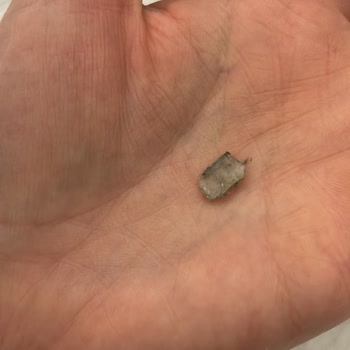 Bebeğimin Sağlığıyla Oynayan Pirinç Patlağı Skandalı